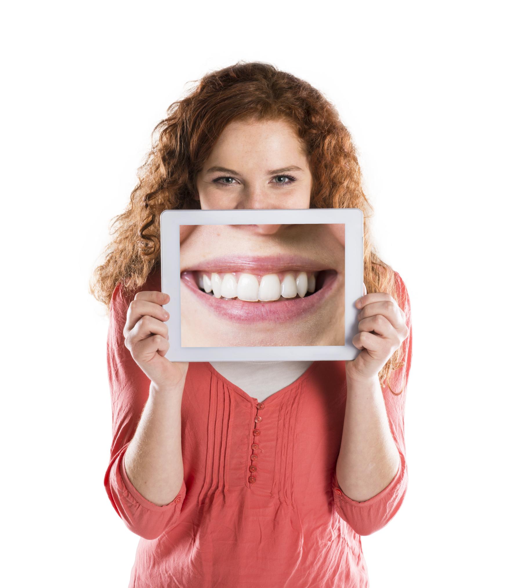 sorriso com faceta, dentes perfeitos