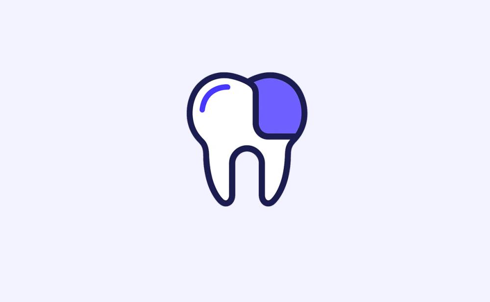 Facetas dentárias feitas na Clarus Odontologia com resultado estético natural